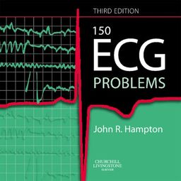 150 ECG Problems - John R. Hampton DM  MA  DPhil  FRCP  FFPM  FESC