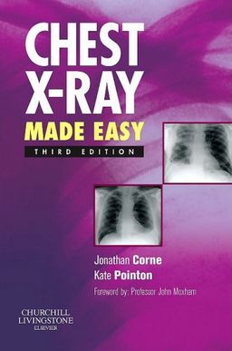 Chest X-Ray Made Easy - Jonathan Corne MA  PhD  FRCP
