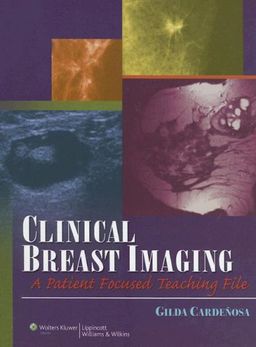 Clinical Breast Imaging: A Patient Focused Teaching File (LWW Teaching File Series) - Gilda Cardenosa Clinical Breast Imaging: A Patient Focused Teaching File (LWW Teaching File Series) - Gilda Cardenosa