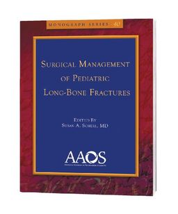 Surgical Management of Pediatric Long-Bone Fractures (Monograph Series (American Academy of Orthopaedic Surgeons)) - Susan A. Surgical Management of Pediatric Long-Bone Fractures (Monograph Series (American Academy of Orthopaedic Surgeons)) - Susan A.