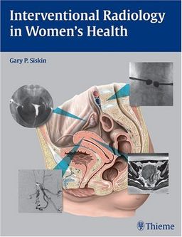 Interventional Radiology in Women's Health - Gary Siskin