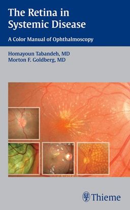 The The Retina in Systemic Disease: A Color Manual of Ophthalmoscopy - Homayoun Tabandeh
