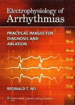 Electrophysiology of Arrhythmias: Practical Images for Diagnosis and Ablation - Reginald T Ho Electrophysiology of Arrhythmias: Practical Images for Diagnosis and Ablation - Reginald T Ho