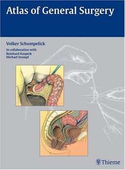 Atlas of General Surgery - Volker Schumpelick