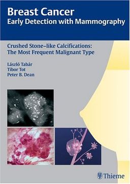 Crushed Stone-like Calcifications: The Most Frequent Malignant Type (Breast Cancer - Early Detection with Mammography) - Laszlo Tabar